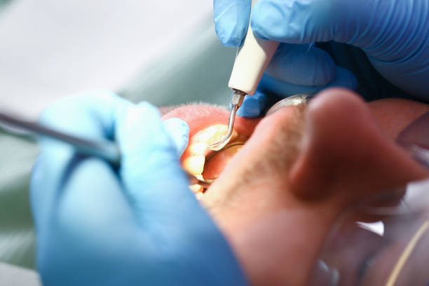Best Holiday Emergency Dentist in Mount Hermon, VA