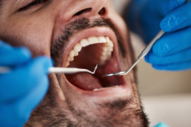 Best Emergency Dental Extractions in Mount Hermon, VA